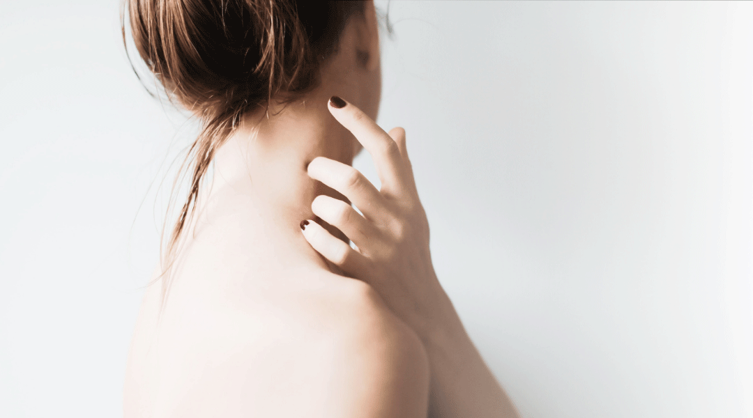 Tengo caspa y picor en la piel ¿Qué me pasa?